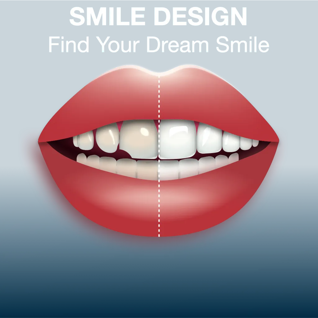 Smile Design Consultation